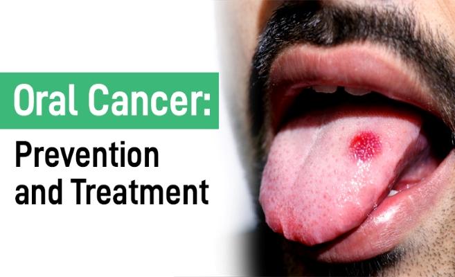 Oral cancer awareness visual